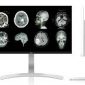 Monitor Grado Médico De 8 MP